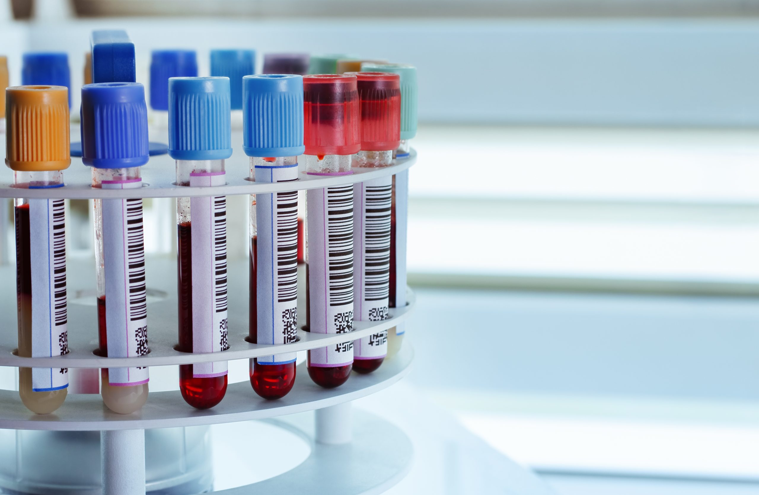 Blood samples in a laboratory centrifuge